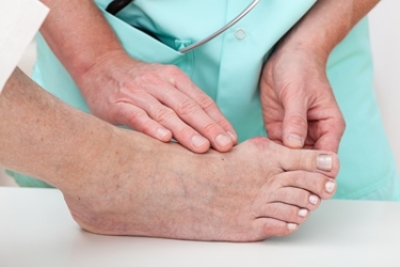 Non-Surgical Treatment for Bunions